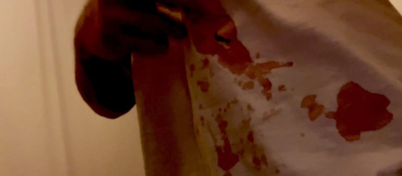 Επίθεση με μαχαίρι δέχτηκε Τούρκος μποξέρ που επέκρινε τον Ερντογάν στην Γερμανία